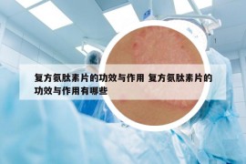 复方氨肽素片的功效与作用 复方氨肽素片的功效与作用有哪些