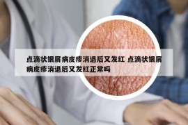 点滴状银屑病皮疹消退后又发红 点滴状银屑病皮疹消退后又发红正常吗