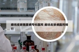 廊坊皮肤银屑病专科医院 廊坊皮肤病医院排行