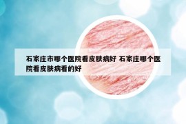 石家庄市哪个医院看皮肤病好 石家庄哪个医院看皮肤病看的好