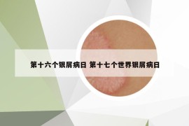 第十六个银屑病日 第十七个世界银屑病日