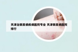 天津治银屑病疾病医院专业 天津银屑病医院排行