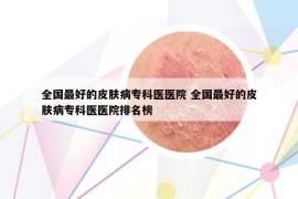 全国最好的皮肤病专科医医院 全国最好的皮肤病专科医医院排名榜