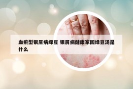 血瘀型银屑病绿豆 银屑病健康家园绿豆汤是什么