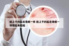 脸上干的起皮像癣一样 脸上干的起皮像癣一样摸起来粗糙