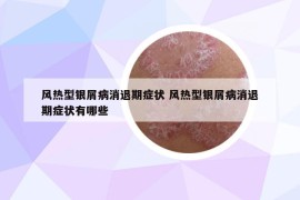 风热型银屑病消退期症状 风热型银屑病消退期症状有哪些