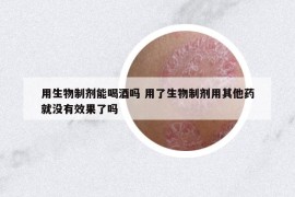 用生物制剂能喝酒吗 用了生物制剂用其他药就没有效果了吗