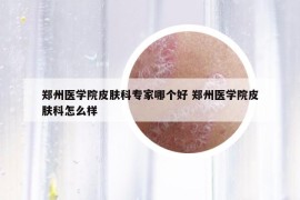 郑州医学院皮肤科专家哪个好 郑州医学院皮肤科怎么样