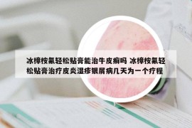 冰樟桉氟轻松贴膏能治牛皮癣吗 冰樟桉氟轻松贴膏治疗皮炎湿疹银屑病几天为一个疗程