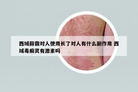 西域藓霸对人使用长了对人有什么副作用 西域毒癣灵有激素吗