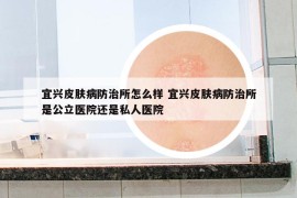 宜兴皮肤病防治所怎么样 宜兴皮肤病防治所是公立医院还是私人医院