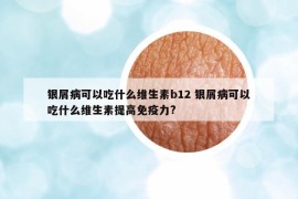 银屑病可以吃什么维生素b12 银屑病可以吃什么维生素提高免疫力?