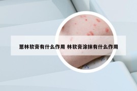 葸林软膏有什么作用 林软膏涂抹有什么作用