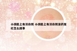 小孩脸上有淡白斑 小孩脸上有淡白斑涂药变红怎么回事