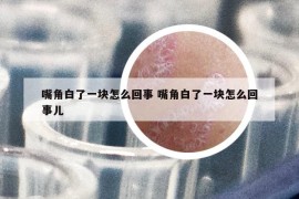 嘴角白了一块怎么回事 嘴角白了一块怎么回事儿