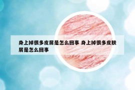 身上掉很多皮屑是怎么回事 身上掉很多皮肤屑是怎么回事