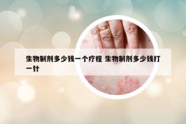 生物制剂多少钱一个疗程 生物制剂多少钱打一针