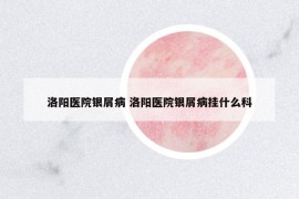 洛阳医院银屑病 洛阳医院银屑病挂什么科