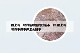 脸上有一块白色跟别的肤色不一样 脸上有一块白不疼不痒怎么回事