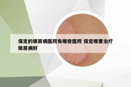 保定的银屑病医院有哪些医院 保定哪里治疗银屑病好