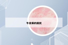 牛皮癣的困扰