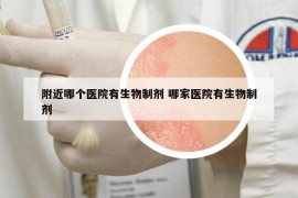 附近哪个医院有生物制剂 哪家医院有生物制剂