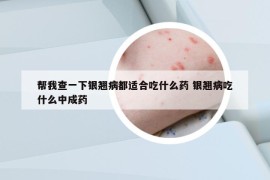 帮我查一下银翘病都适合吃什么药 银翘病吃什么中成药