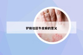 铲除社区牛皮癣的意义