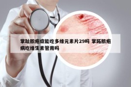 掌趾脓疱症能吃多维元素片29吗 掌跖脓疱病吃维生素管用吗