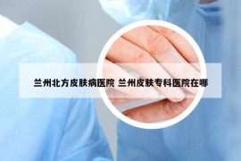 兰州北方皮肤病医院 兰州皮肤专科医院在哪