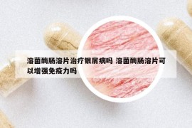 溶菌酶肠溶片治疗银屑病吗 溶菌酶肠溶片可以增强免疫力吗