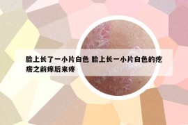 脸上长了一小片白色 脸上长一小片白色的疙瘩之前痒后来疼