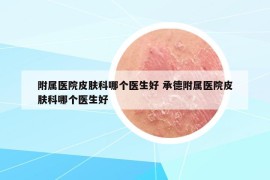 附属医院皮肤科哪个医生好 承德附属医院皮肤科哪个医生好