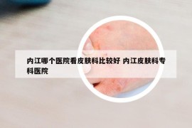 内江哪个医院看皮肤科比较好 内江皮肤科专科医院