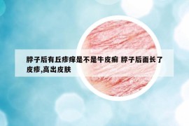 脖子后有丘疹痒是不是牛皮癣 脖子后面长了皮疹,高出皮肤