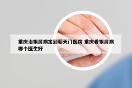 重庆治银屑病定到朝天门医院 重庆看银屑病哪个医生好
