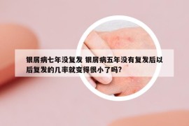 银屑病七年没复发 银屑病五年没有复发后以后复发的几率就变得很小了吗?