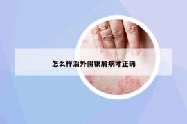 怎么样治外阴银屑病才正确