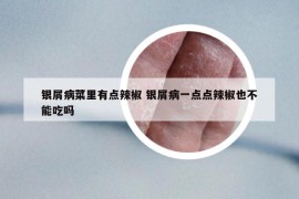银屑病菜里有点辣椒 银屑病一点点辣椒也不能吃吗