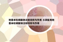 地塞米松磷酸钠注射功效与作用 小孩能用地塞米松磷酸钠注射功效与作用