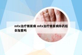 mtx治疗银屑病 mtx治疗银屑病停药后会加重吗