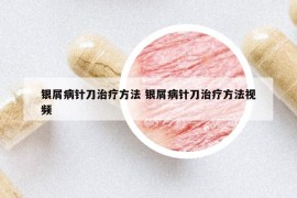 银屑病针刀治疗方法 银屑病针刀治疗方法视频