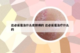 达必妥是治什么皮肤病的 达必妥是治疗什么的