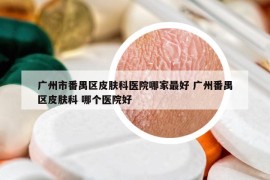 广州市番禺区皮肤科医院哪家最好 广州番禺区皮肤科 哪个医院好