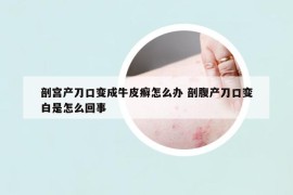 剖宫产刀口变成牛皮癣怎么办 剖腹产刀口变白是怎么回事