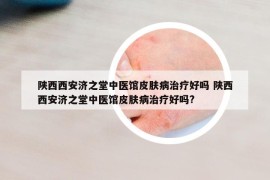 陕西西安济之堂中医馆皮肤病治疗好吗 陕西西安济之堂中医馆皮肤病治疗好吗?