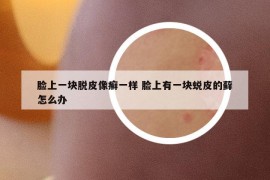 脸上一块脱皮像癣一样 脸上有一块蜕皮的藓怎么办