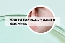 洛阳银屑病早期症状to刘长江 郑州市银屑病研究所刘长江