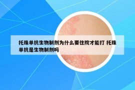 托珠单抗生物制剂为什么要住院才能打 托珠单抗是生物制剂吗