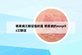 银屑病三联征指的是 银屑病的auspitz三联征